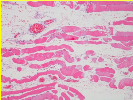 reorganization 60 min after endopeel